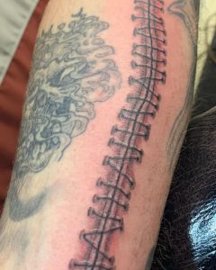 Black and White Stitches tattoo 1