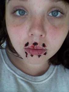 Stitched Mouth Tattoo 1
