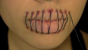 Stitched Mouth Tattoo 4