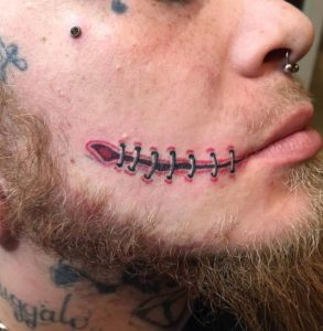 Stitched Mouth Tattoos