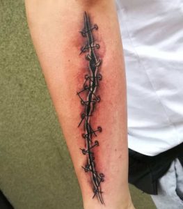 Stitches Arm Tattoo 5