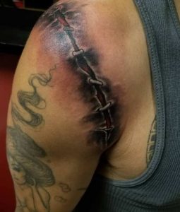 Stitches Arm Tattoo 6