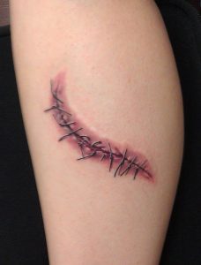 Stitches Tattoo