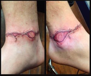 Stitches Tattoo Legs 2