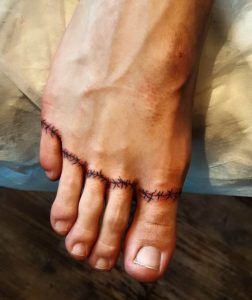 Stitches Tattoo Legs 3