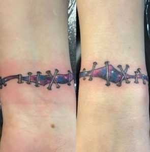 Stitches Tattoo Wrist 4