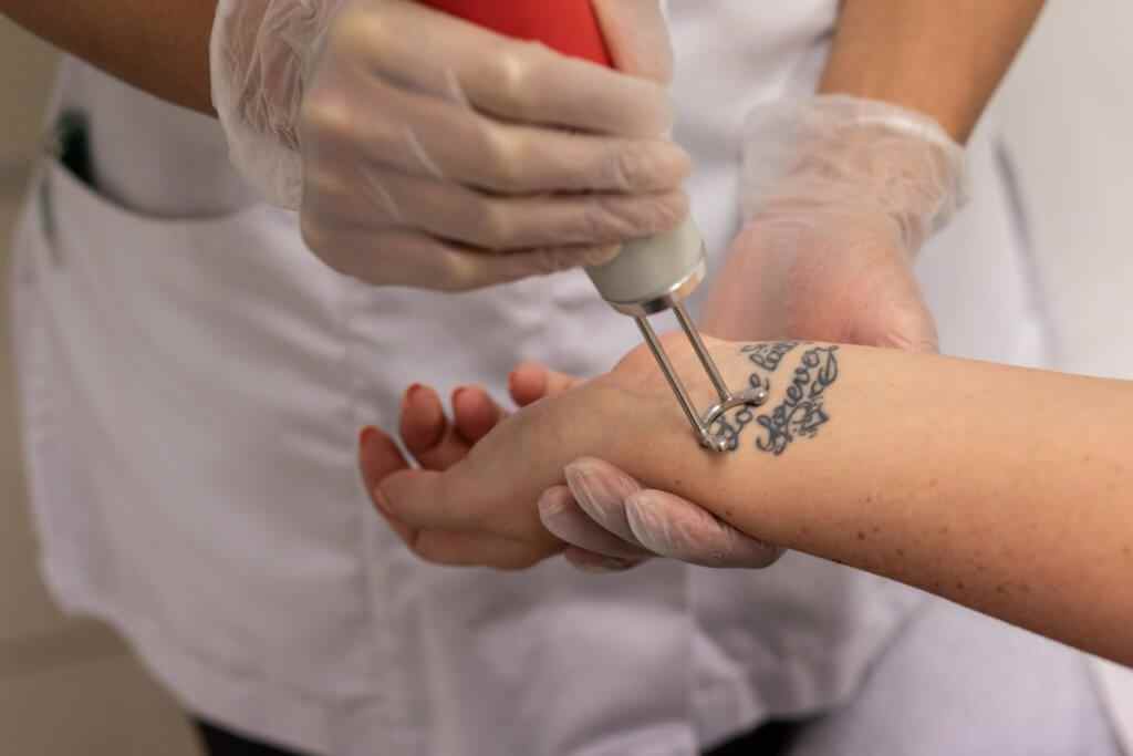 Can You Donate Blood After Laser Tattoo Removal