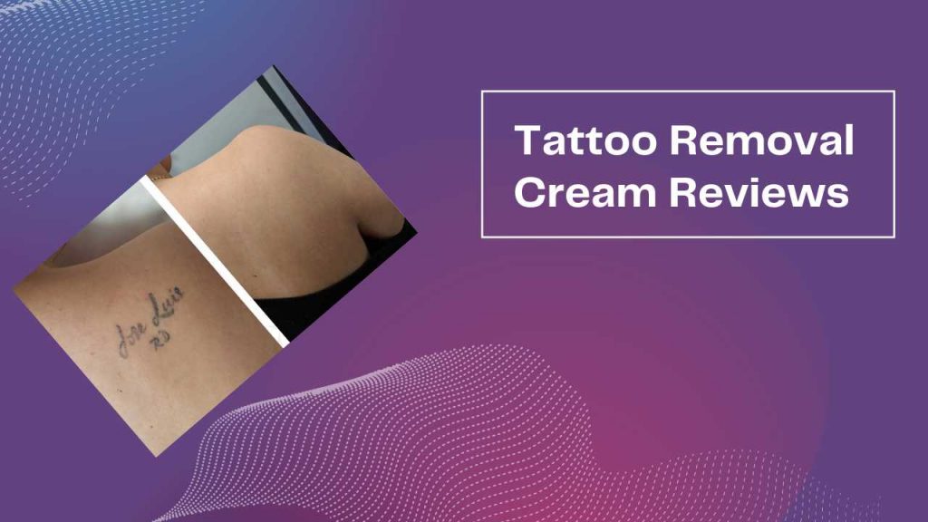Best Tattoo Removal Cream