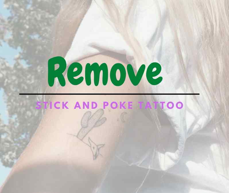 Remove Stick and Poke Tattoo